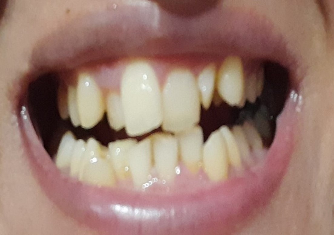 After